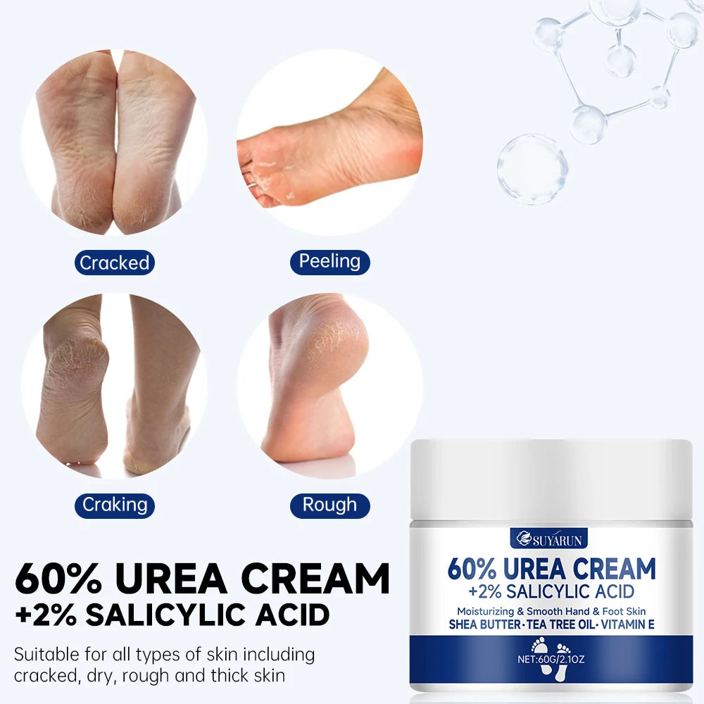 Crema de Urea 60% para Talones Agrietados